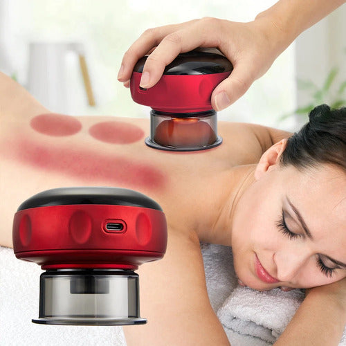 Electric Vacuum Cupping Massager with Heat – Wireless Suction Therapy Device for Muscle Recovery & Circulation